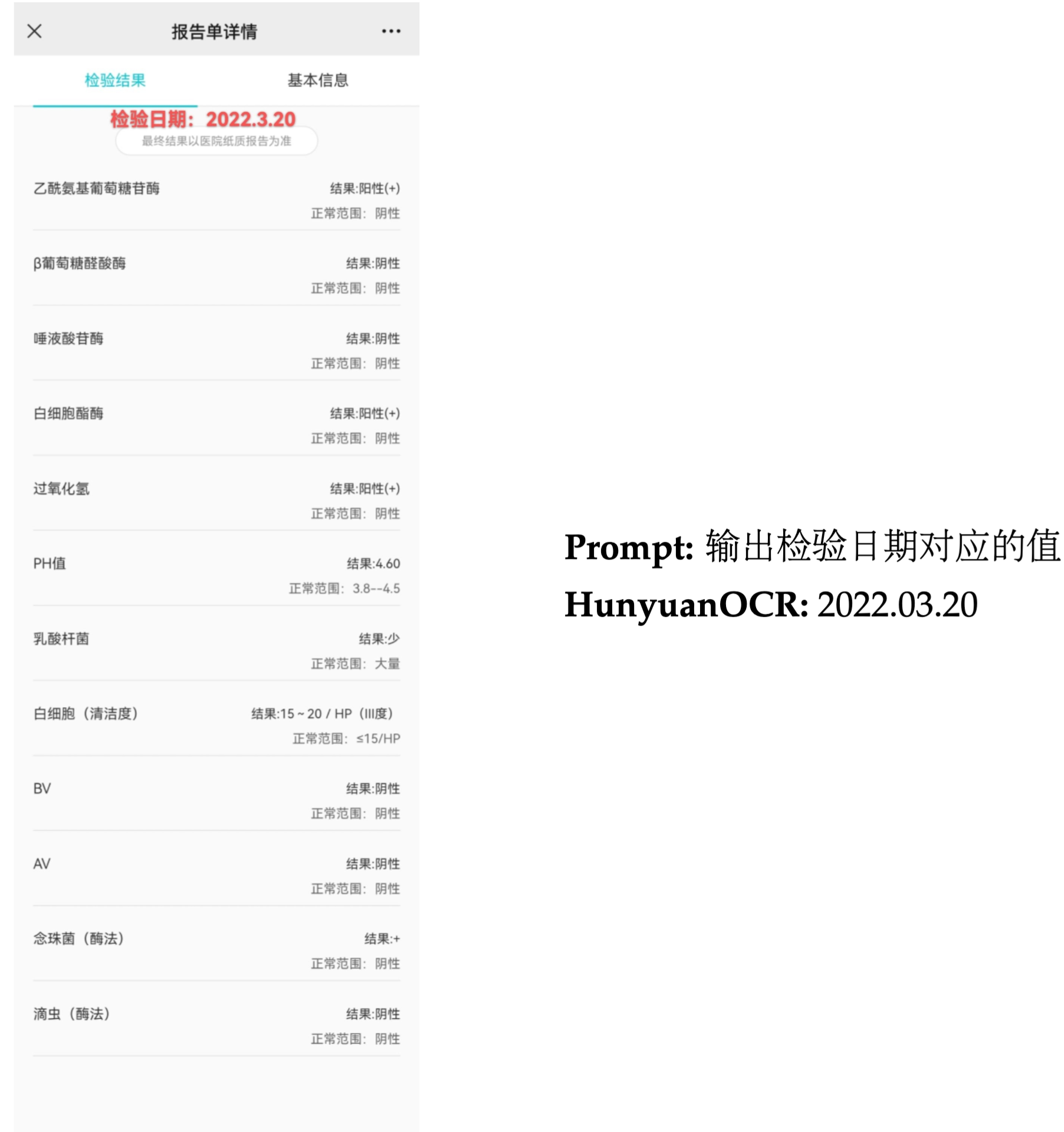 Information Extraction Sample